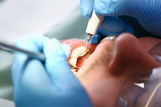 Best Emergency Dental Care for Trauma or Injury in University Park, TX